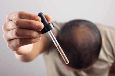 Elinde bir damlatıcı olan adam gri arka planda izole edilmiş kafa derisine serum ya da diğer saç bakım ürünlerini uygulayacak..