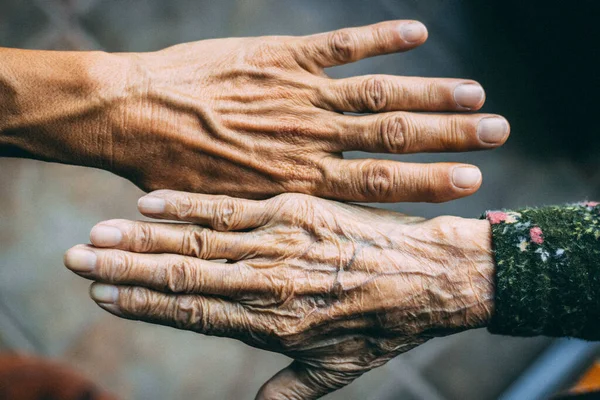 Closeup Wrinkly Young Person Hands Blurred Background — Stock Photo, Image