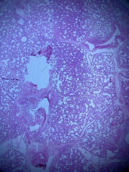 Lungvävnadens Histologi Den Mobila Mikroskopiska Vyn Och Färgning Rosa Lila — Stockfoto