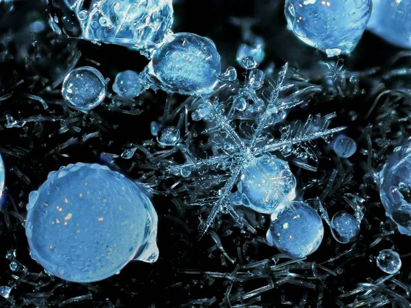 Mikroskop Altında Koyu Arkaplanı Bulanık Mikroskobik Bir Tıbbi Örnek Yakın — Stok fotoğraf