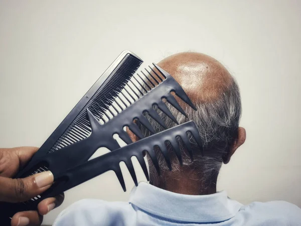 An occipital area of an old man with multiple combs in front