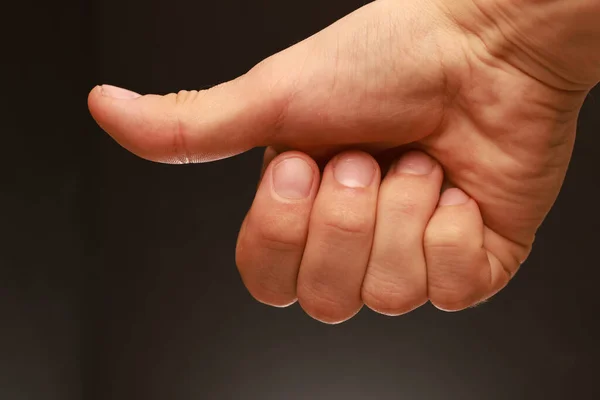 茶色のぼんやりとした背景に引き伸ばされた親指で手の拳の閉鎖 — ストック写真