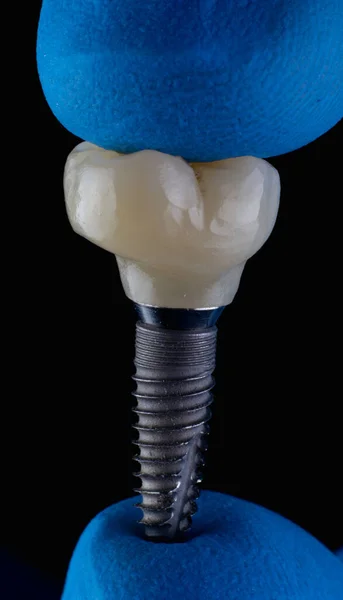 Close Vertical Implante Dentário Entre Dois Dedos Luva Fundo Preto — Fotografia de Stock