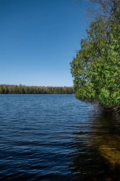 Tiro Vertical Lago Floresta Cercada Por Natureza Exuberante Verão Bela — Fotografia de Stock