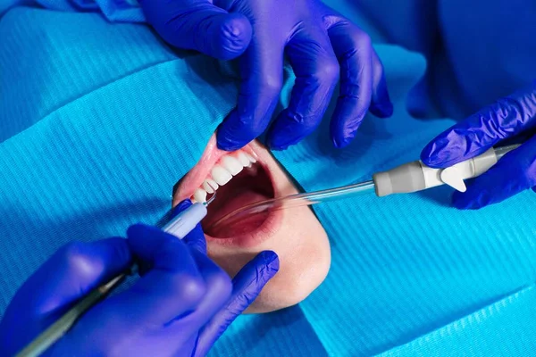 Крупный План Рук Перчатках Проверяющих Зубы Пациента — стоковое фото