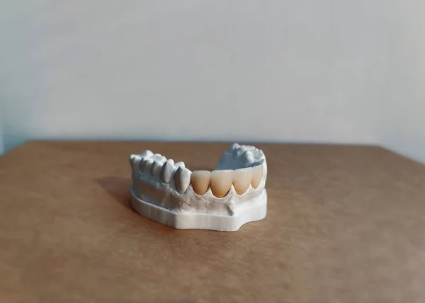 コピースペースのある茶色の表面に白い歯科補綴物のクローズアップショット — ストック写真