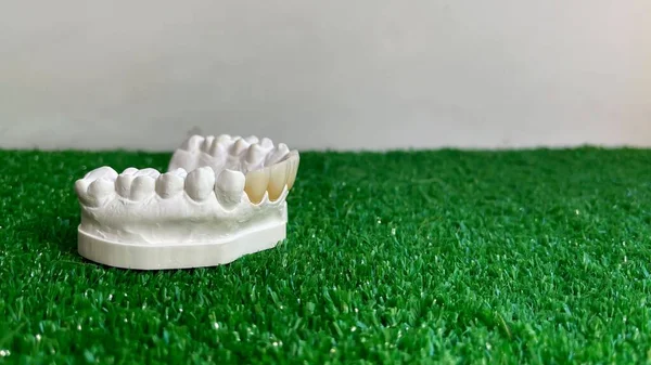 Closeup Shot White Dental Prosthesis Artificial Grass Copy Space — Stock Photo, Image