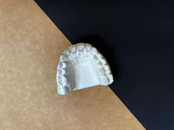 Horní Pohled Záběr Bílé Zubní Protézy Hnědém Černém Pozadí Kopírovacím — Stock fotografie