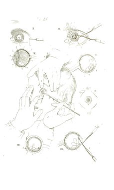 19. yüzyıl anatomisi ders kitabı. Siyah beyaz.
