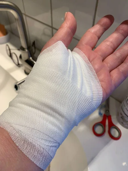 Vertikal Bild Bandagerad Hand Ovanför Diskhon — Stockfoto