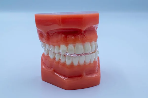 Closeup Shot Teeth Typodont White Table — Stock Photo, Image