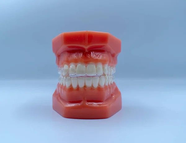 Zwykły Typodont Dentystyczny Niebieskim Tłem Używany Celów Edukacyjnych — Zdjęcie stockowe