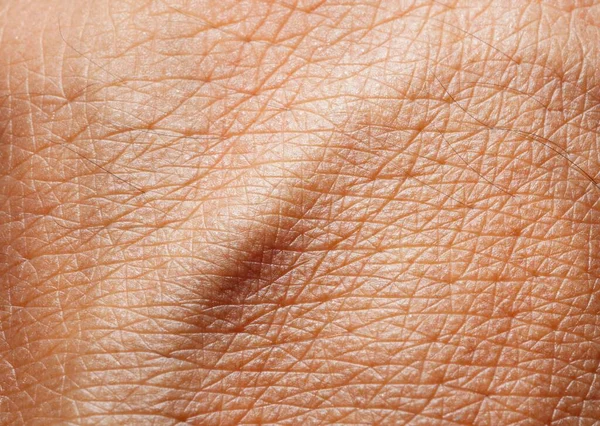 Närbild Mänskliga Hudens Textur — Stockfoto