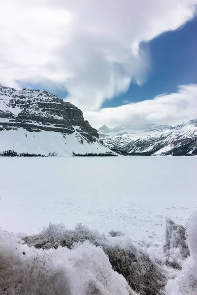 Вертикальний Знімок Гір Вкритих Снігом Хмарами Банфі Канада — стокове фото