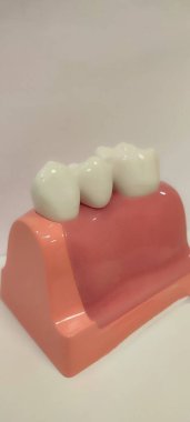 Diş aletlerinin dikey çekimi - protez, üst hizalama, anestezi şırıngası, silikon