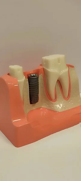 Plan Vertical Des Instruments Dentaires Prothèses Invisalign Seringue Anesthésie Silicone — Photo