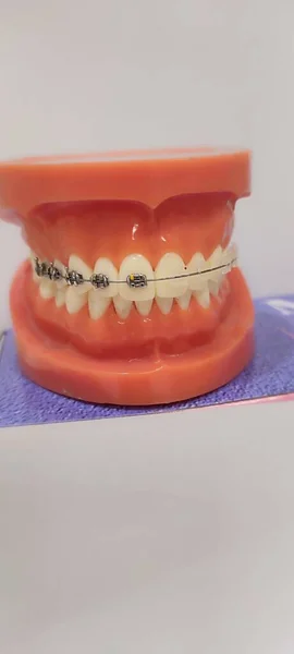 Una Inyección Vertical Instrumentos Dentales Prótesis Invisalign Jeringa Anestesia Silicona —  Fotos de Stock