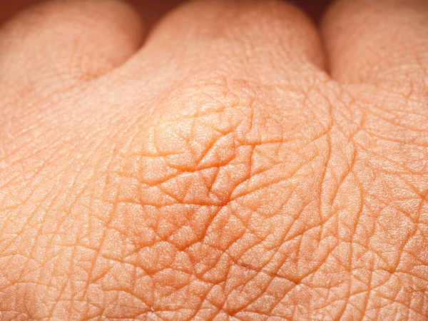 Close Van Human Skin Textur — Stockfoto