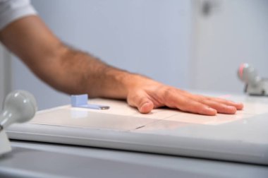 Bir radyoloji seansında el röntgeni seansı devam ediyor.
