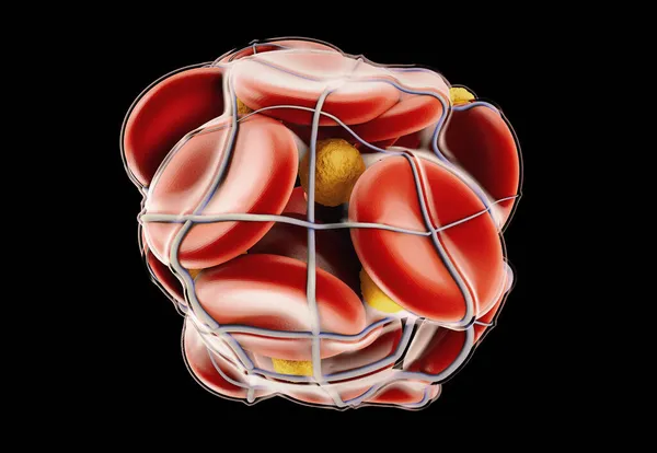 3D-ілюстрація тромбозу глибокої вени або тромбів крові. Емболія, відсічний контур включено Ліцензійні Стокові Зображення