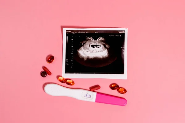 Εγκυμοσύνη Θεραπεία Κατά Διάρκεια Της Εγκυμοσύνης Απειλή Για Έμβρυο — Φωτογραφία Αρχείου