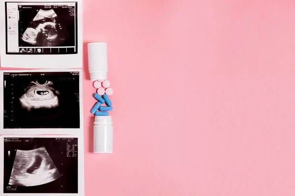 Εγκυμοσύνη Θεραπεία Κατά Διάρκεια Της Εγκυμοσύνης Απειλή Για Έμβρυο Αντιγραφή — Φωτογραφία Αρχείου