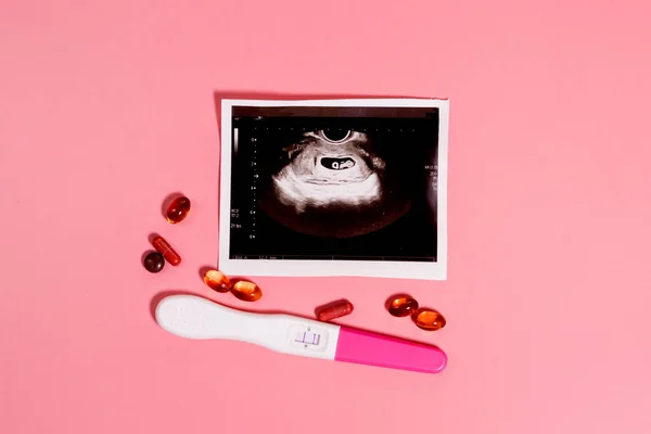 Εγκυμοσύνη Θεραπεία Κατά Διάρκεια Της Εγκυμοσύνης Απειλή Για Έμβρυο — Φωτογραφία Αρχείου