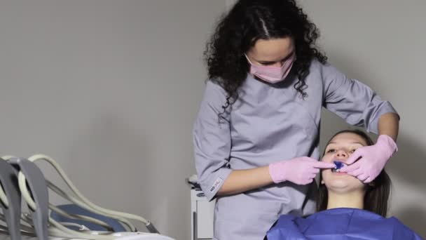 De orthodontist met behulp van tandafdrukken lade op vrouwelijke tanden. Tandspatel met print voor tandheelkundig implantaat — Stockvideo