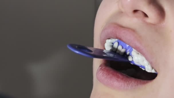 Orthodontist Met Behulp Van Tandafdrukken Lade Vrouwelijke Tanden Tandspatel Met — Stockvideo