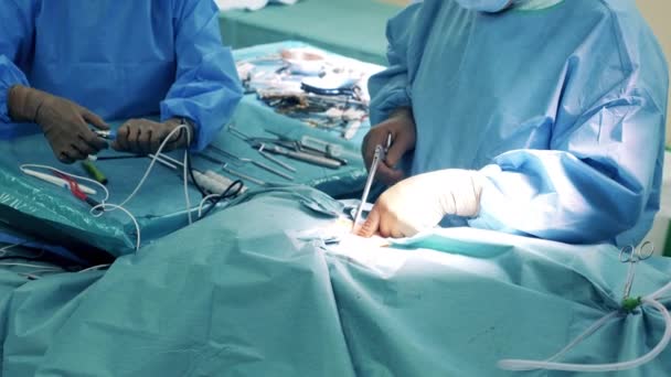 Хирург делает укол во время операции — стоковое видео