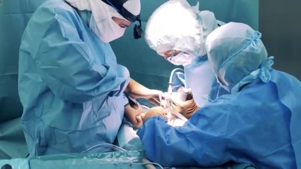 Team di medici stanno eseguendo un intervento chirurgico — Video Stock