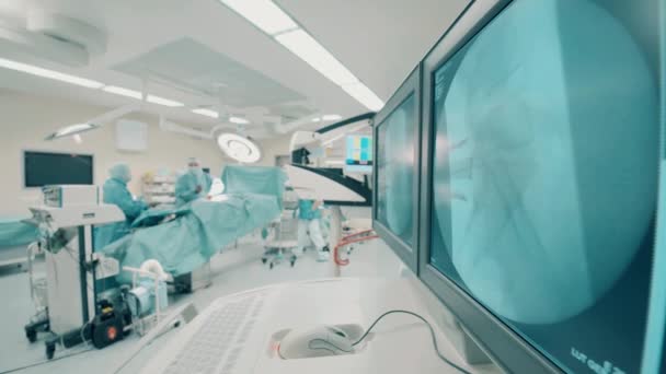 Monitoren met scans van patiëntenbotten in de operatiekamer — Stockvideo