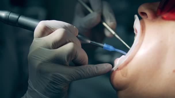 クローズアップで撮影された歯科治療プロセス — ストック動画