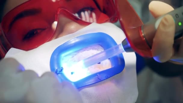Orvos fehérítő betegek fogak professzionális felszereléssel — Stock videók