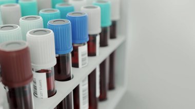 blood sample close shot, 3d rendering