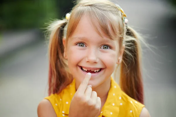 Crianças Desdentadas Sorriem Pequena Menina Bonito Criança Mostra Primeiro Dente — Fotografia de Stock