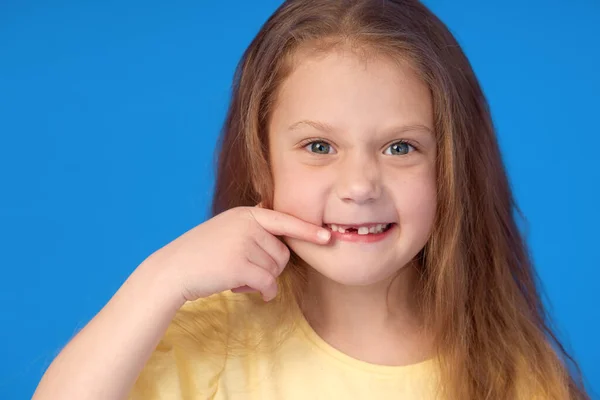 Criança Sem Dentes Menina Bonito Sorri Amplamente Fundo Azul Primeiro — Fotografia de Stock