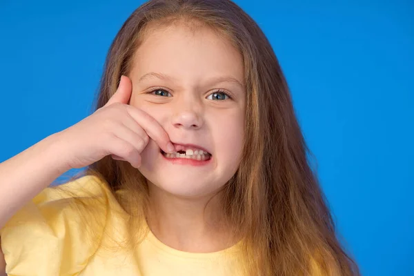 Criança Sem Dentes Menina Bonito Sorri Amplamente Fundo Azul Primeiro — Fotografia de Stock