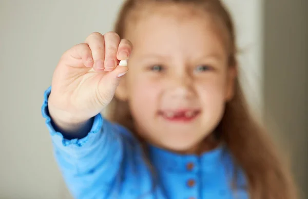 Criança Sem Dentes Menina Bonito Sorri Amplamente Primeiro Dente Leite — Fotografia de Stock