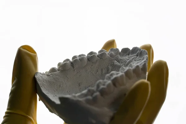 Showing Patient Plaster Mouth Taken Impression Patient Himself Dentist Holds — Fotografia de Stock