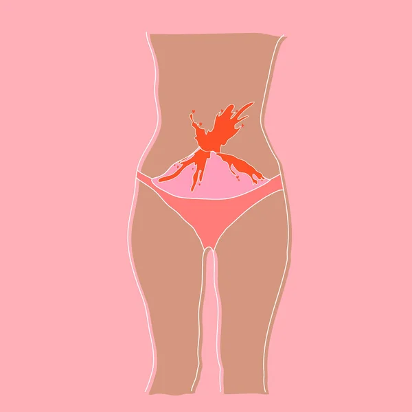 Leaflet Menstruation Menstruation Causes Discomfort Possible Pain Normal Woman Scars — стоковый вектор