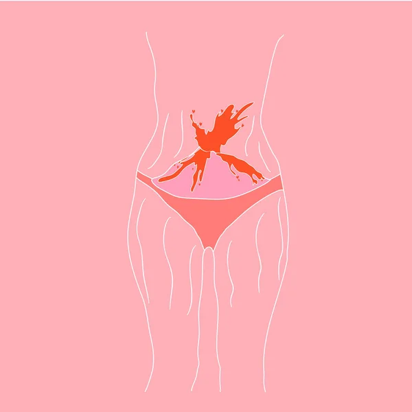 Leaflet Menstruation Menstruation Causes Discomfort Possible Pain Normal Woman Scars — Stockvektor