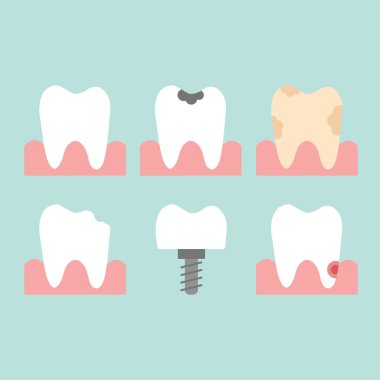 Beyaz ve çürük dişler, diş implantı simgesi. Farklı diş durumları olan bir vektör ayarlandı. İzole düz illüstrasyon