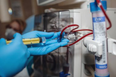 Hemşire böbrek hastalıkları kronik hasta ve diyaliz sistemi ekipmanları için hemodiyaliz sürecine başlıyor.