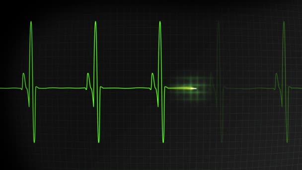 Ekg Faster Heartbeat Display Monitor — Video Stock