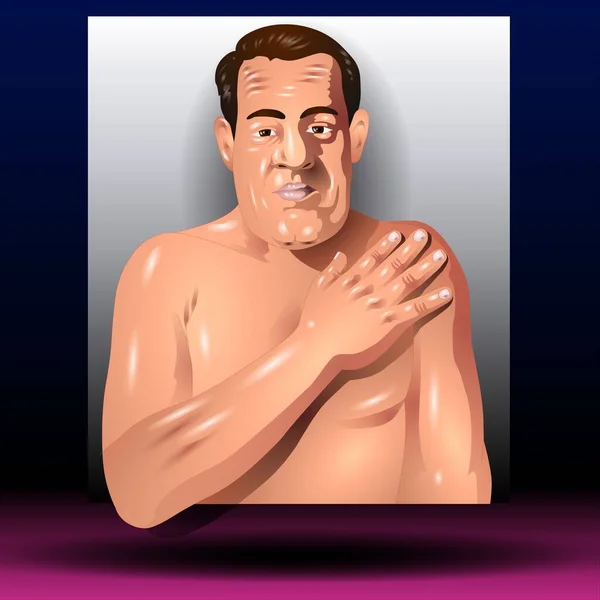 Fla - source file available - Acromegaly is a rare condition where the body produces too much growth hormone, causing body tissues and bones to grow more quickly. Over time, this leads to abnormally large hands and feet.