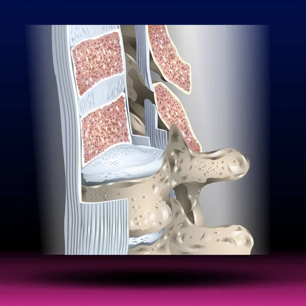 Fla - source file available - The anterior longitudinal ligament is a ligament that runs down the anterior surface of the spine. It traverses all of the vertebral bodies and intervertebral discs on their ventral side.