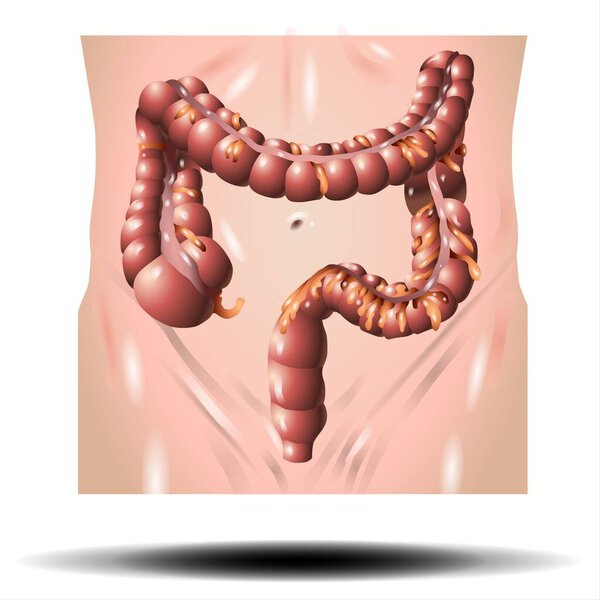 Fla source file available - The long, tube-like organ that is connected to the small intestine at one end and the anus at the other. The large intestine has four parts: cecum, colon, rectum, and anal canal.