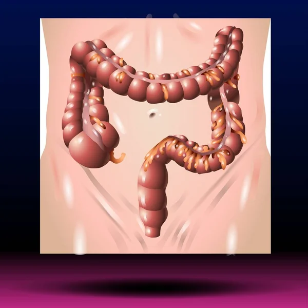 Fla source file available - The long, tube-like organ that is connected to the small intestine at one end and the anus at the other. The large intestine has four parts: cecum, colon, rectum, and anal canal.