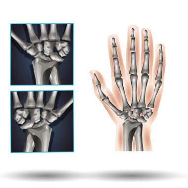 Bilek Anatomisi - Fla kaynak dosyası mevcut - Karpal kemikleri. İnsan eli anatomisi. Bileğin küçük kemikleri: Skapoid, Lunate, Triquetrum, Pisiform, Trapezium, Trapezoid, Capitate ve Hamate. Vektör illüstrasyonu